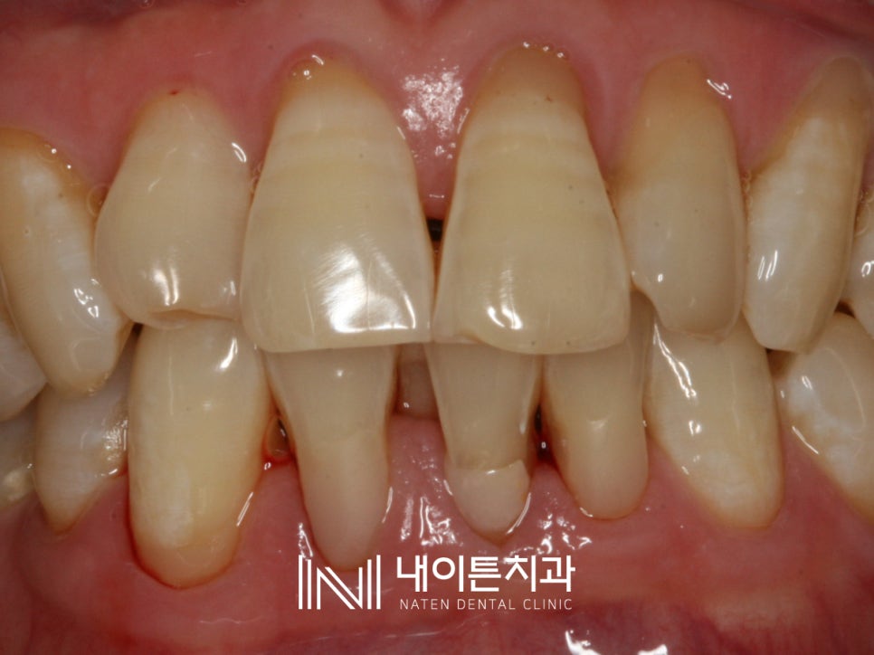 Treatment case image 7