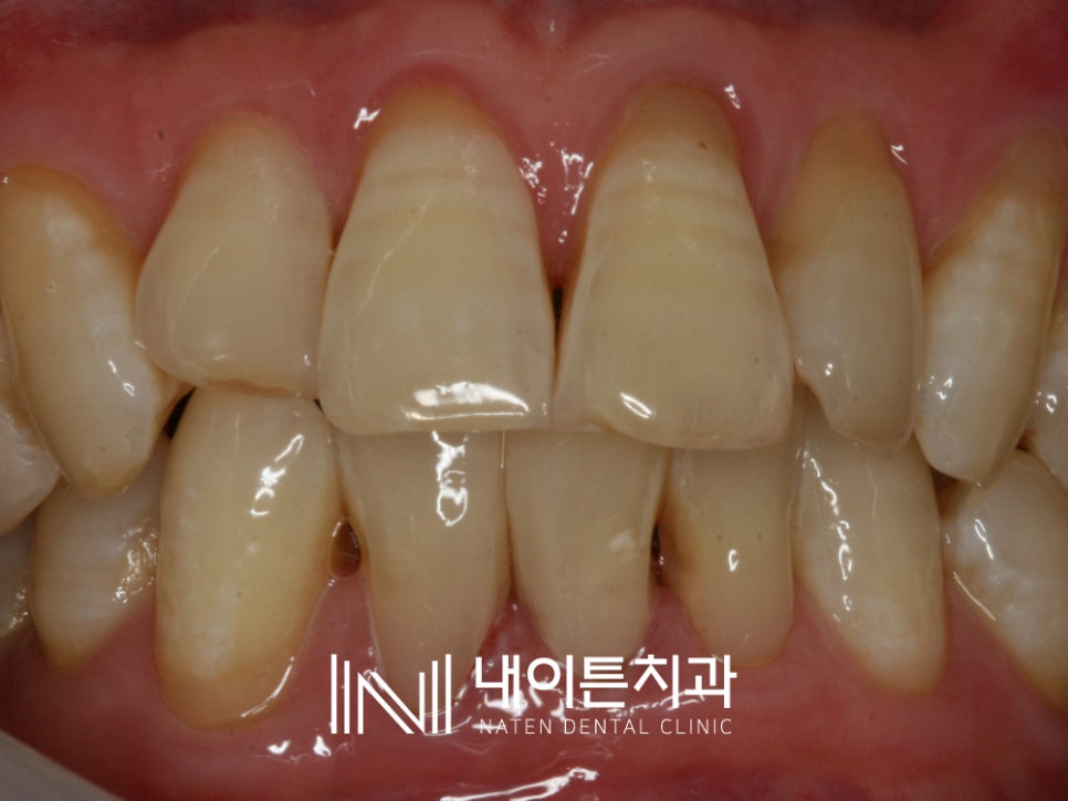 Treatment case image 8