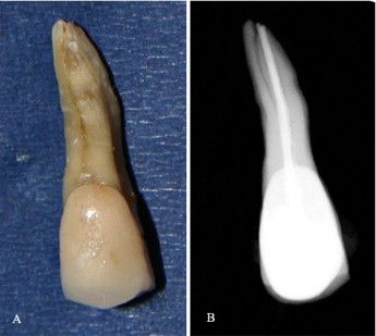 Treatment case image 1