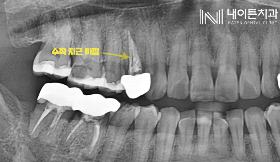 Treatment case image 2