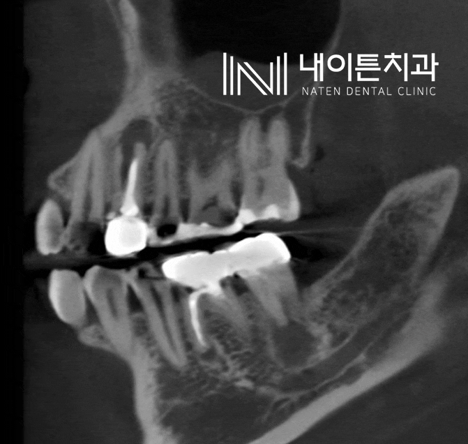 Treatment case image 4