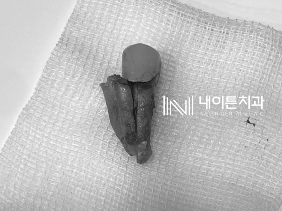 Treatment case image 6