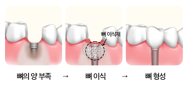 Treatment case image 8