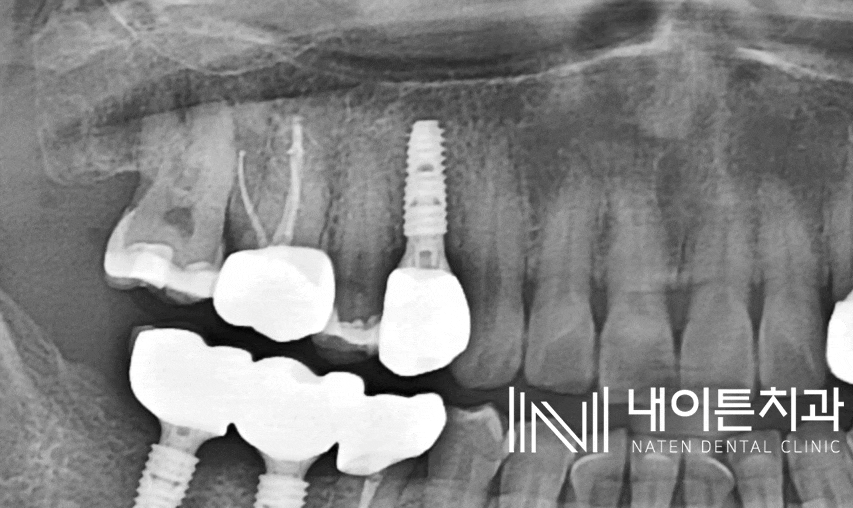Treatment case image 9