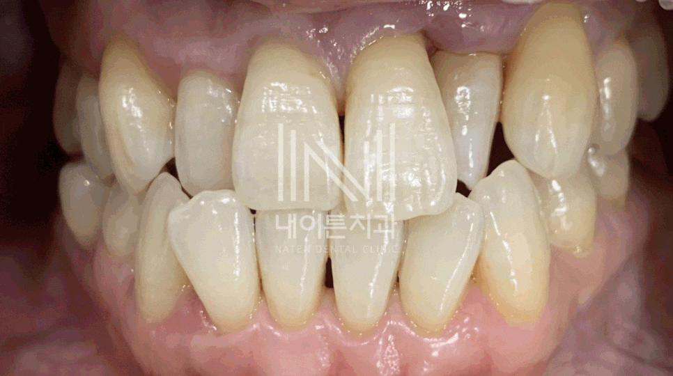 Treatment case image 1