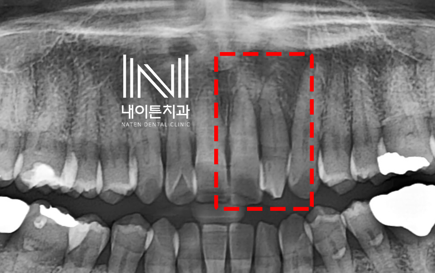 Treatment case image 2