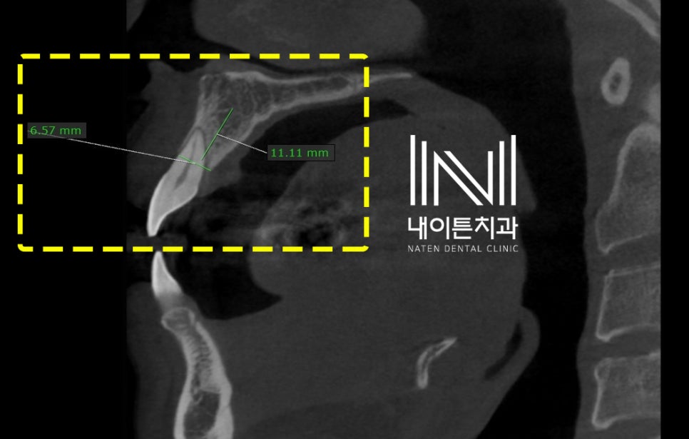Treatment case image 4