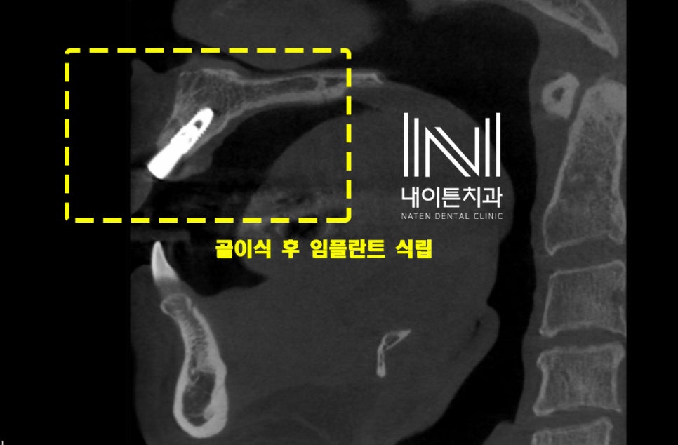 Treatment case image 9
