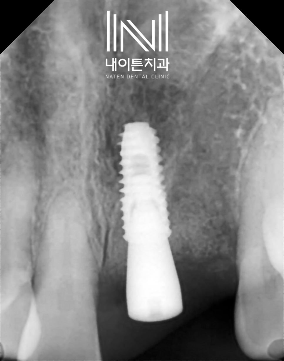 Treatment case image 10