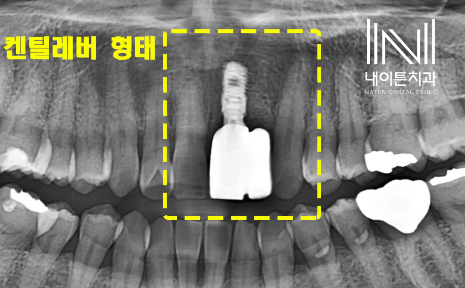 Treatment case image 13