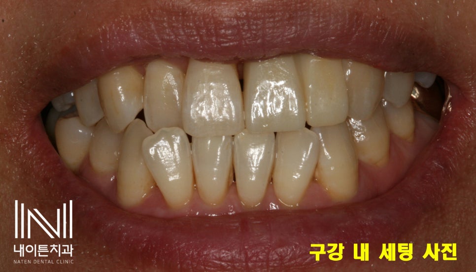 Treatment case image 15