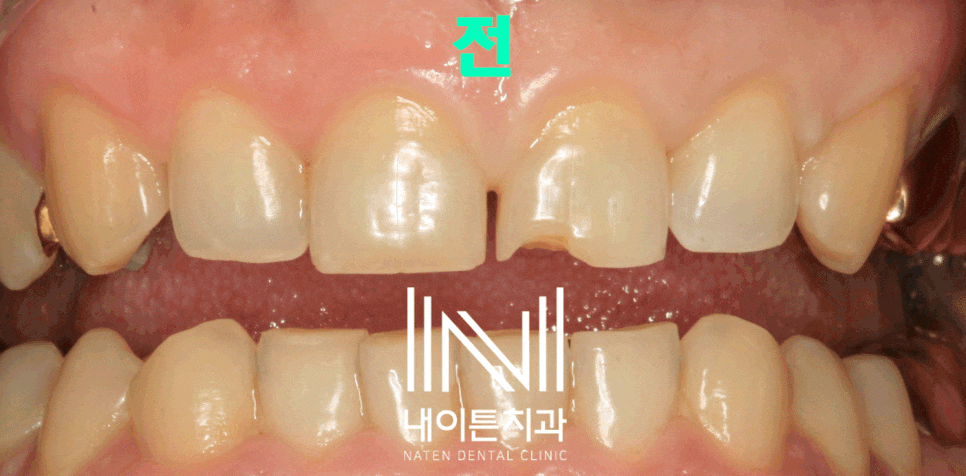 Treatment case image 1