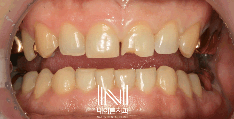 Treatment case image 2
