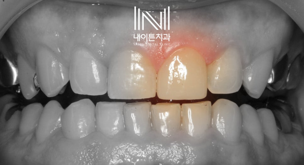 Treatment case image 3