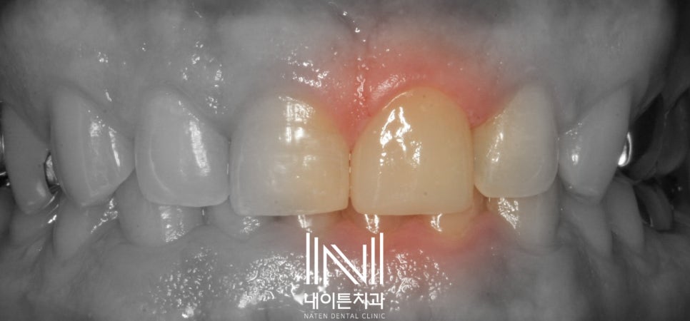 Treatment case image 7