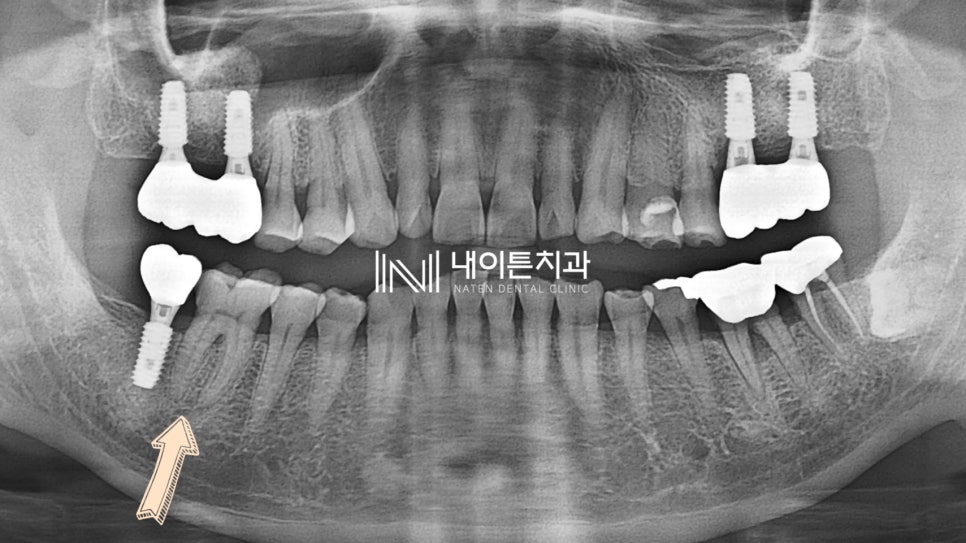 Treatment case image 1