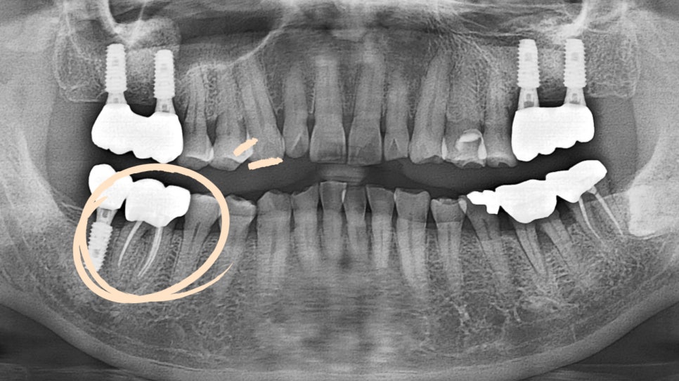 Treatment case image 5