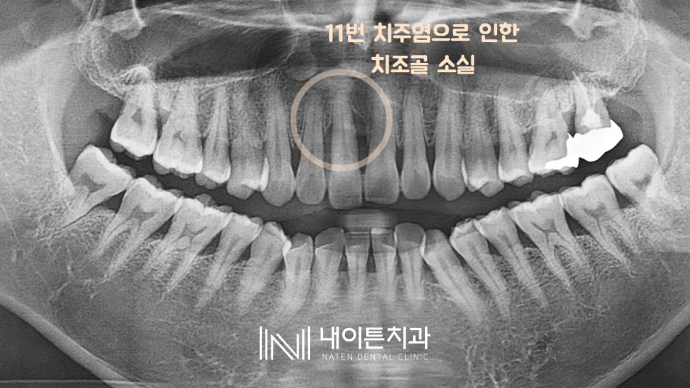 Treatment case image 1