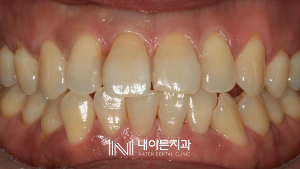 Treatment case image 2
