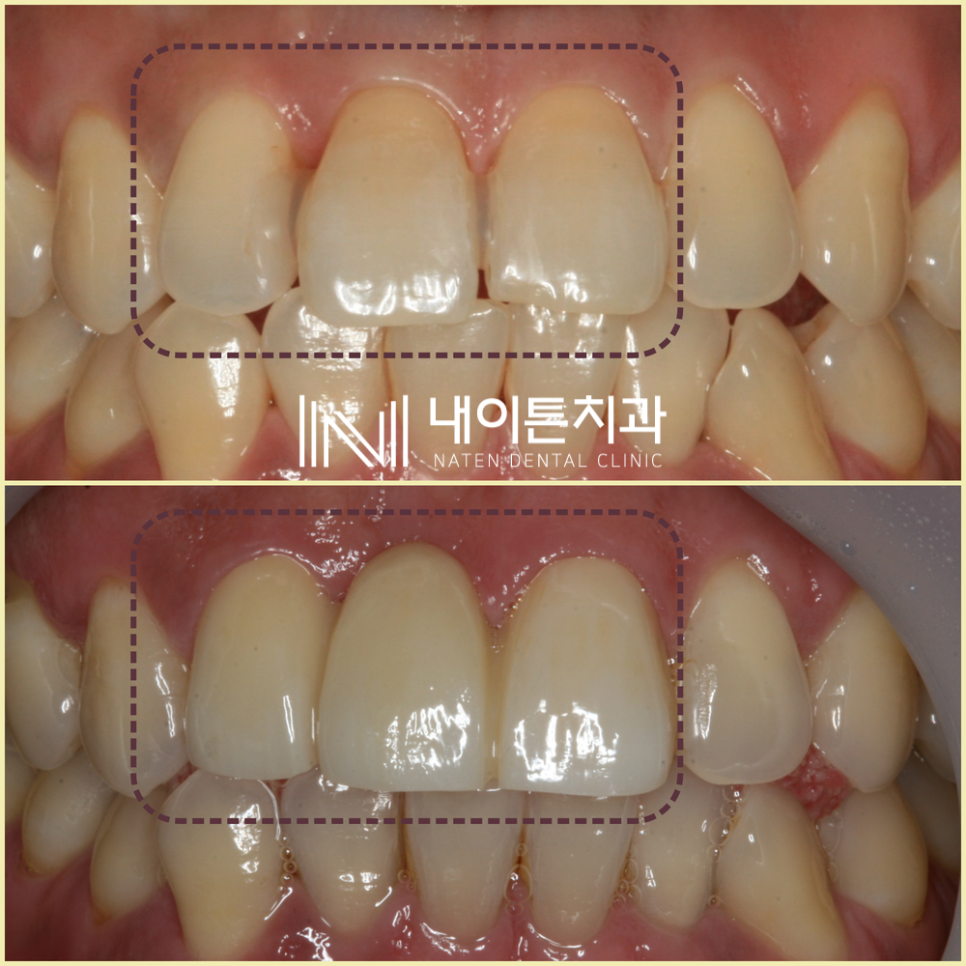 Treatment case image 5