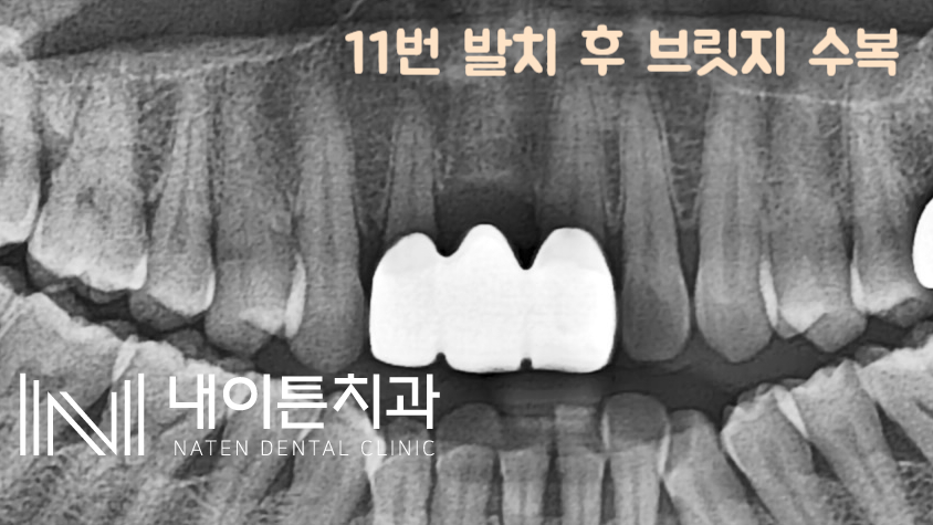 Treatment case image 6