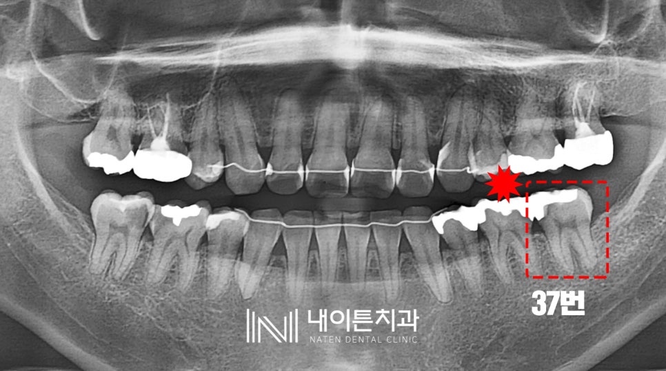 Treatment case image 1