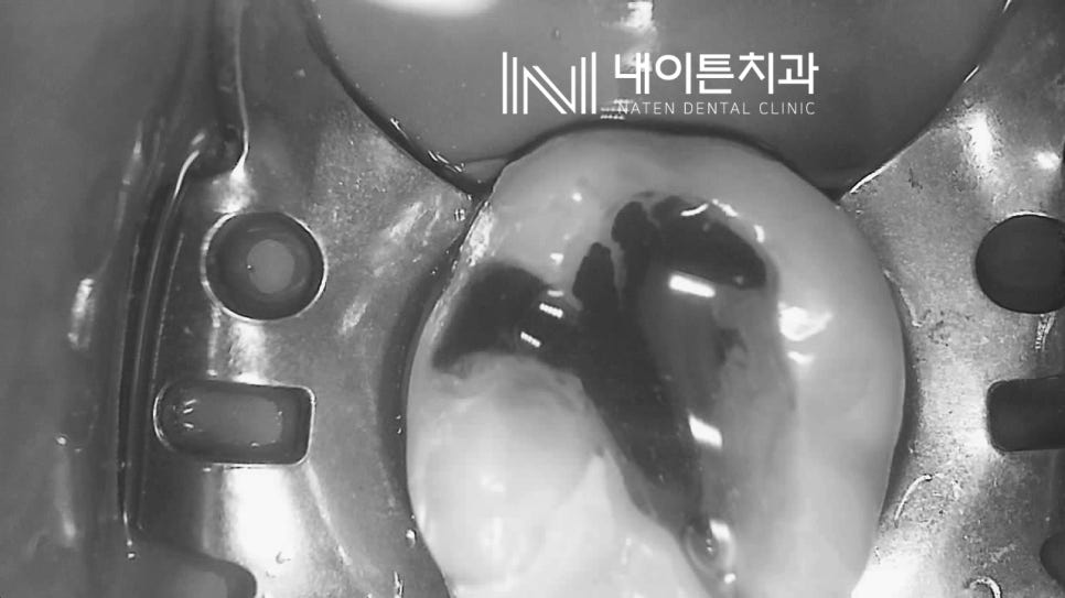 Treatment case image 8