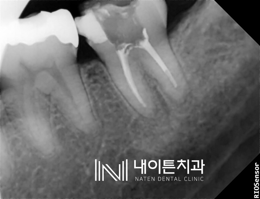 Treatment case image 9