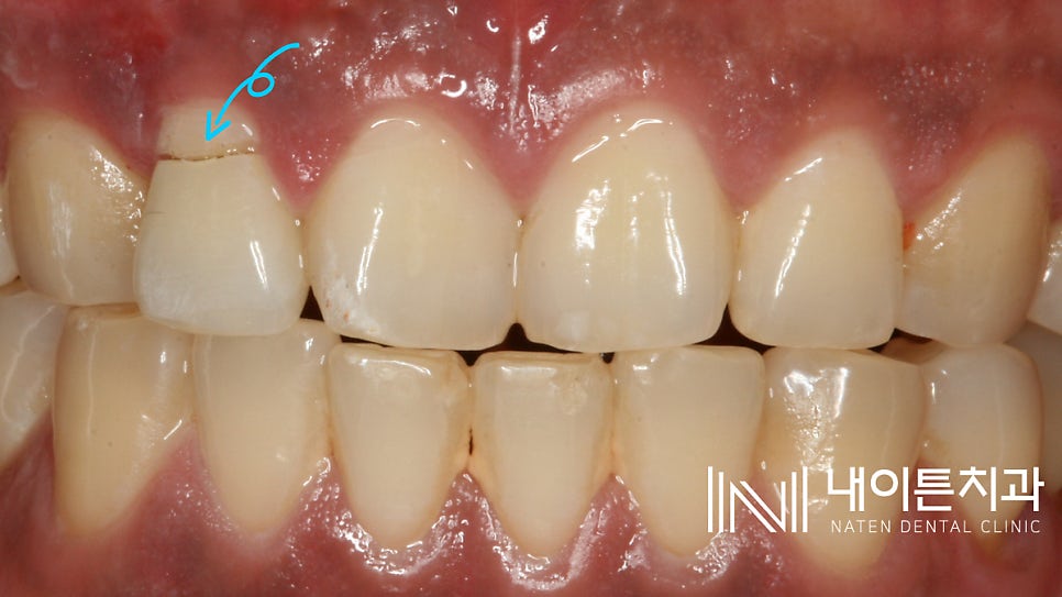 Treatment case image 1