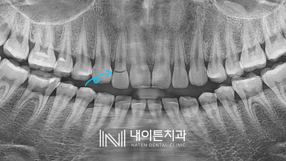 Treatment case image 2