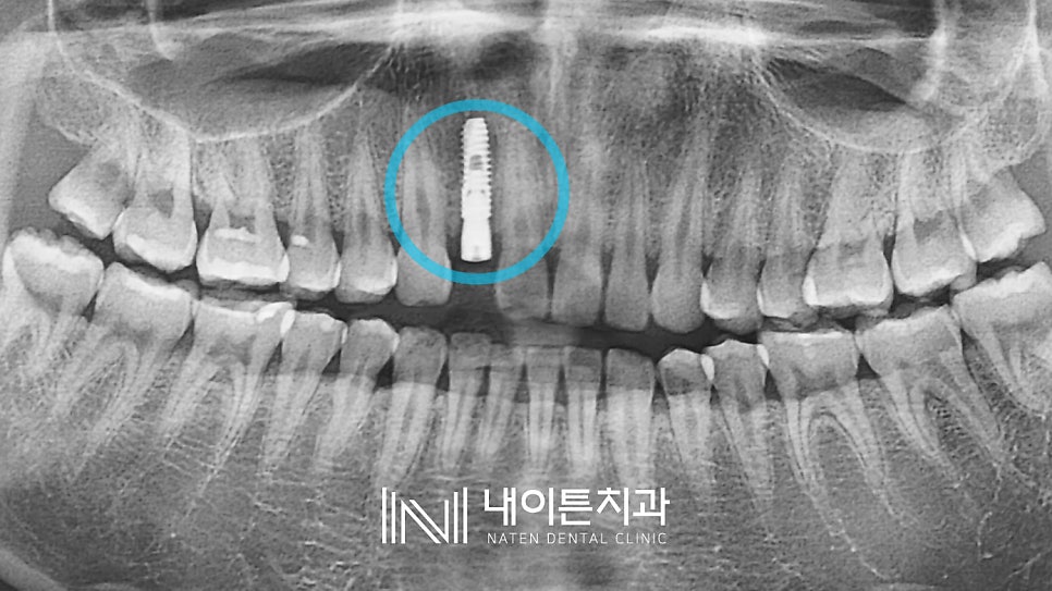 Treatment case image 7