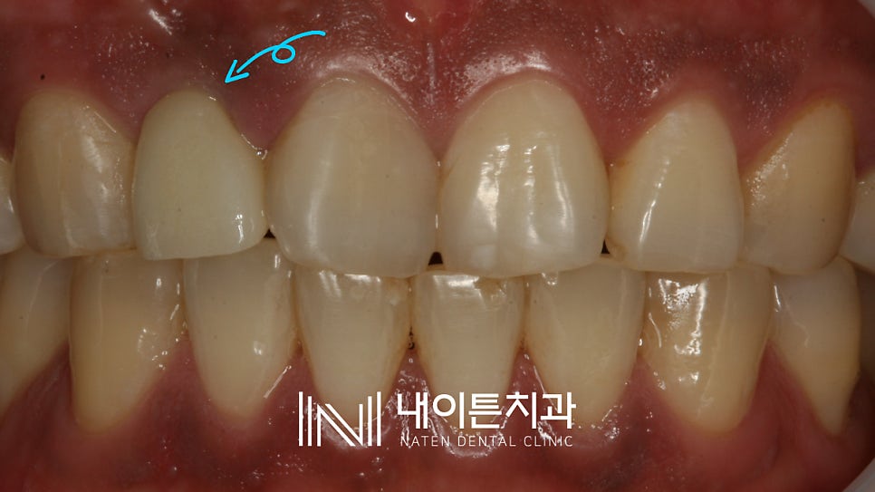 Treatment case image 9