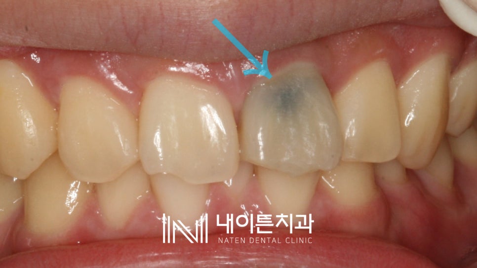 Treatment case image 1