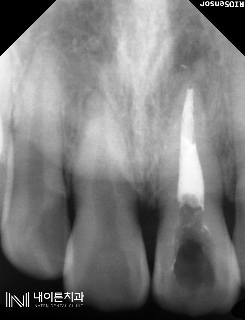 Treatment case image 6