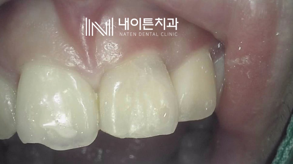 Treatment case image 7