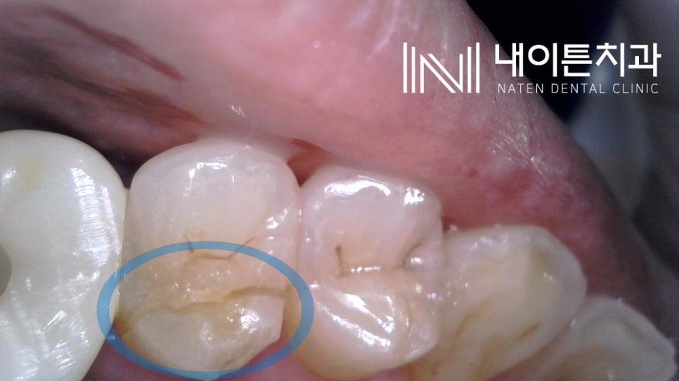 Treatment case image 1