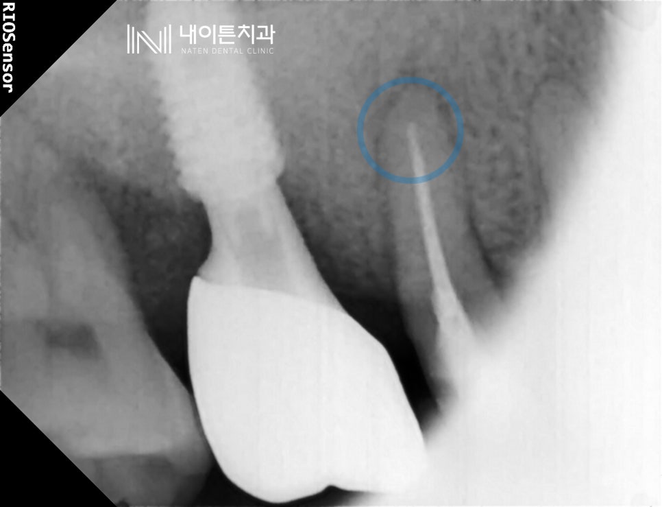 Treatment case image 7