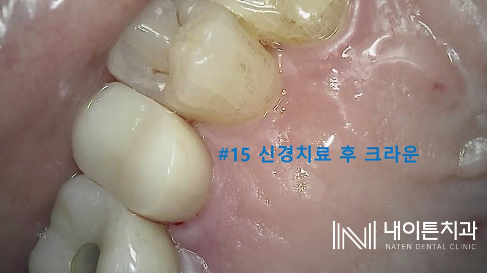 Treatment case image 9