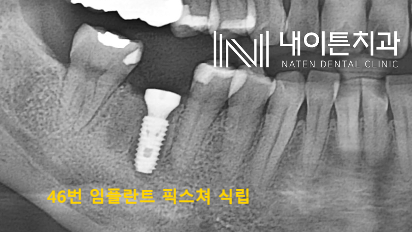 Treatment case image 5