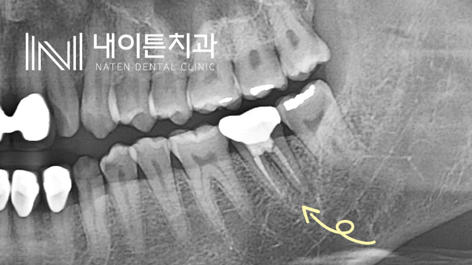 Treatment case image 1