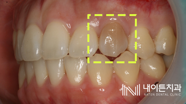 Treatment case image 1