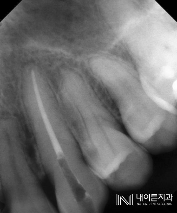 Treatment case image 6