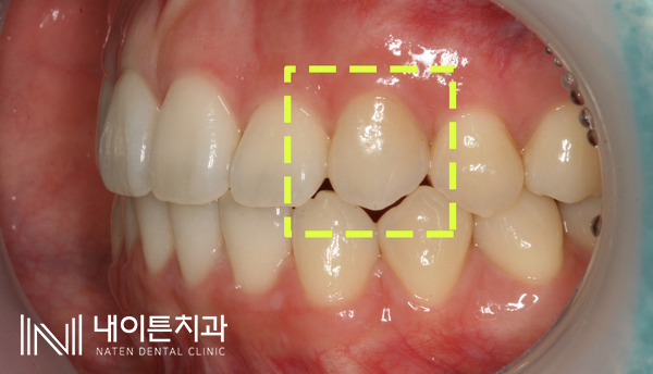Treatment case image 9