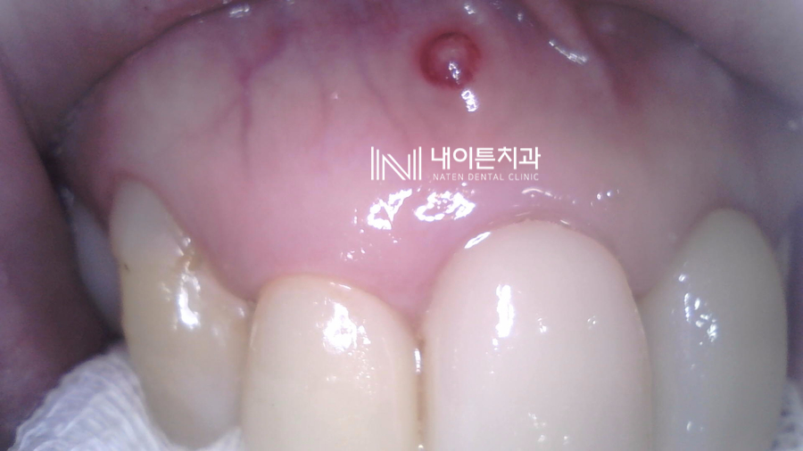 Treatment case image 1