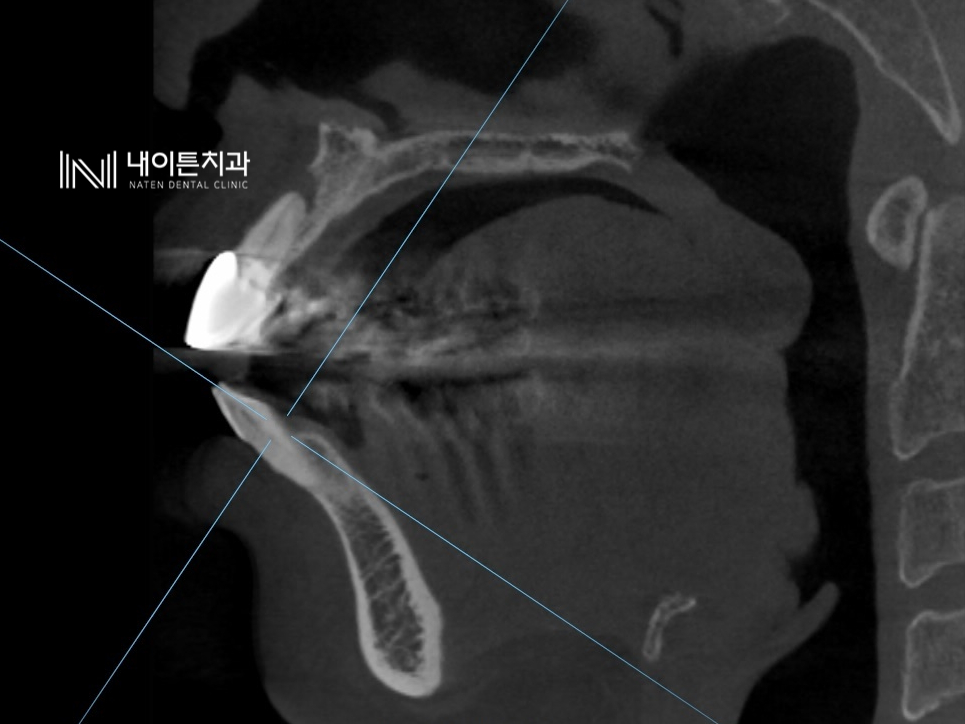 Treatment case image 5