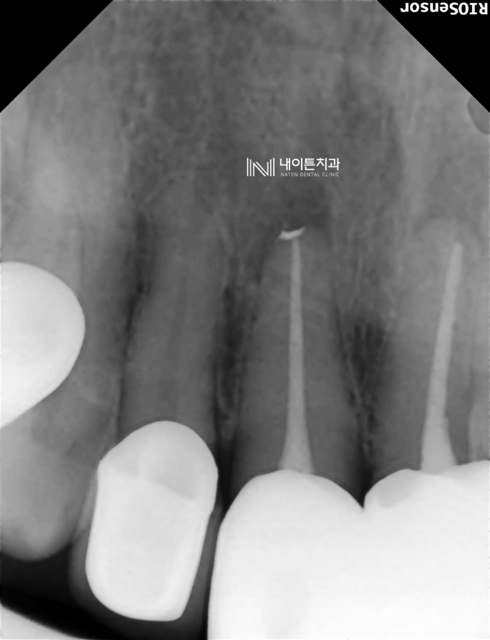Treatment case image 6