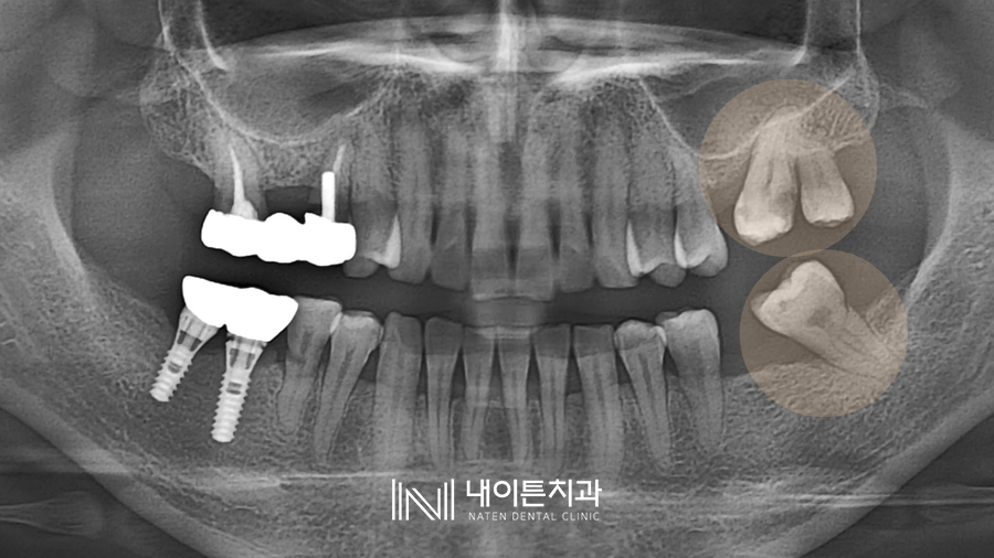 Treatment case image 1