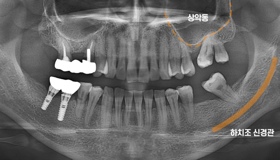 Treatment case image 3