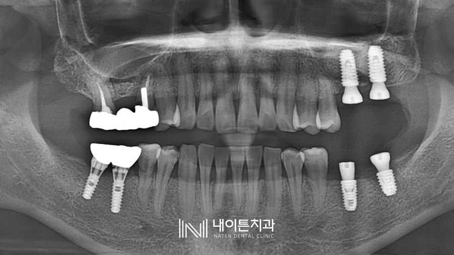 Treatment case image 4