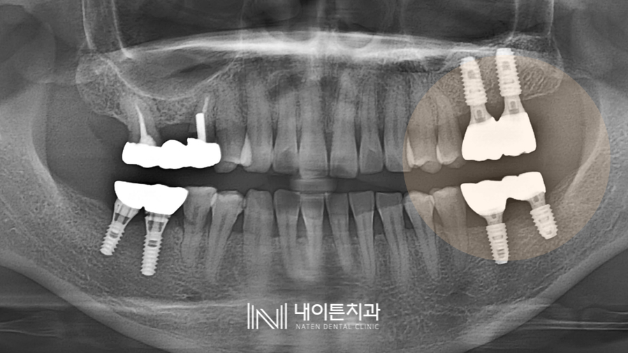 Treatment case image 6